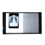 Negatoscopio Led 2 caras