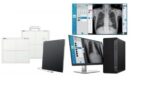 Equipo Rayos X Osteo Pulmonar Digitalizado - Imagen 2